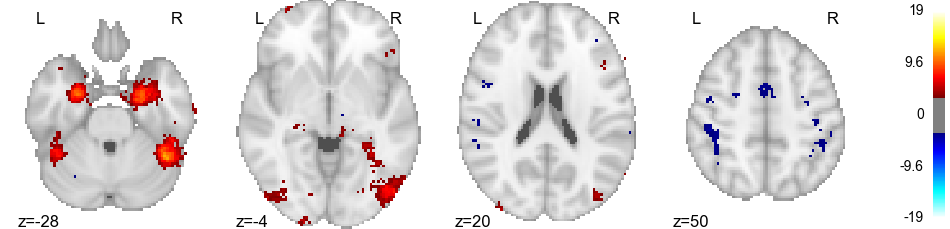 ../../_images/sphx_glr_plot_contextual_prior_001.png