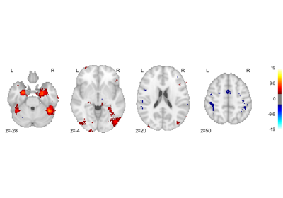 ../_images/sphx_glr_plot_contextual_prior_thumb.png