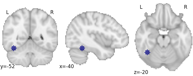 ../../_images/sphx_glr_plot_decode_roi_001.png