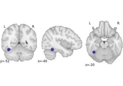 ../_images/sphx_glr_plot_decode_roi_thumb.png