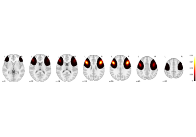 ../_images/sphx_glr_plot_show_topic_figures_thumb.png